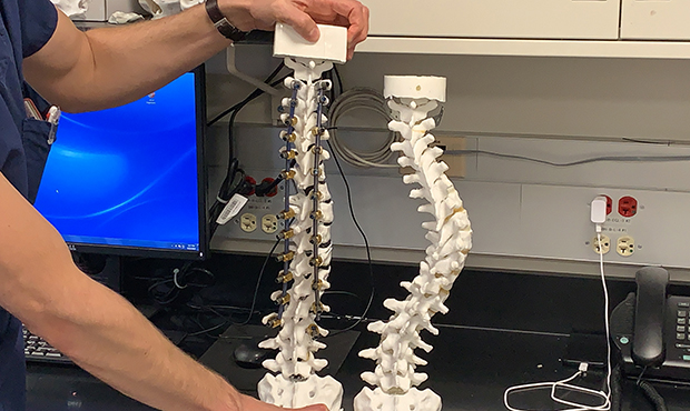 Phoenix doctors printing spines to practice for surgery