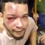 Cellphone video from inside El Helicoide documented the result of the severe beating of Gregory Sanabria, a political prisoner, on May 16, 2018.  (Screenshot/Gabriel Valles)