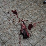 
              A shoe covered in blood lies on the floor at an emergency surgery in a maternity hospital converted into a medical ward in Mariupol, Ukraine, Wednesday, March 2, 2022. Russian forces have seized a strategic Ukrainian seaport and besieged another. Those moves are part of efforts to cut the country off from its coastline even as Moscow said Thursday it was ready for talks to end the fighting. (AP Photo/Evgeniy Maloletka)
            