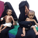 
              Women hold their malnourished children at Hays Rural Hospital in Hodeida, Yemen, Oct. 11, 2022. For years starvation has been an everyday threat for Yemen’s children. Now, as the war threatens to escalate between the country’s warring parties after months of a tenuous truce, there are fears that it could get worse. (AP Photo/Hussam Al-Bakry)
            