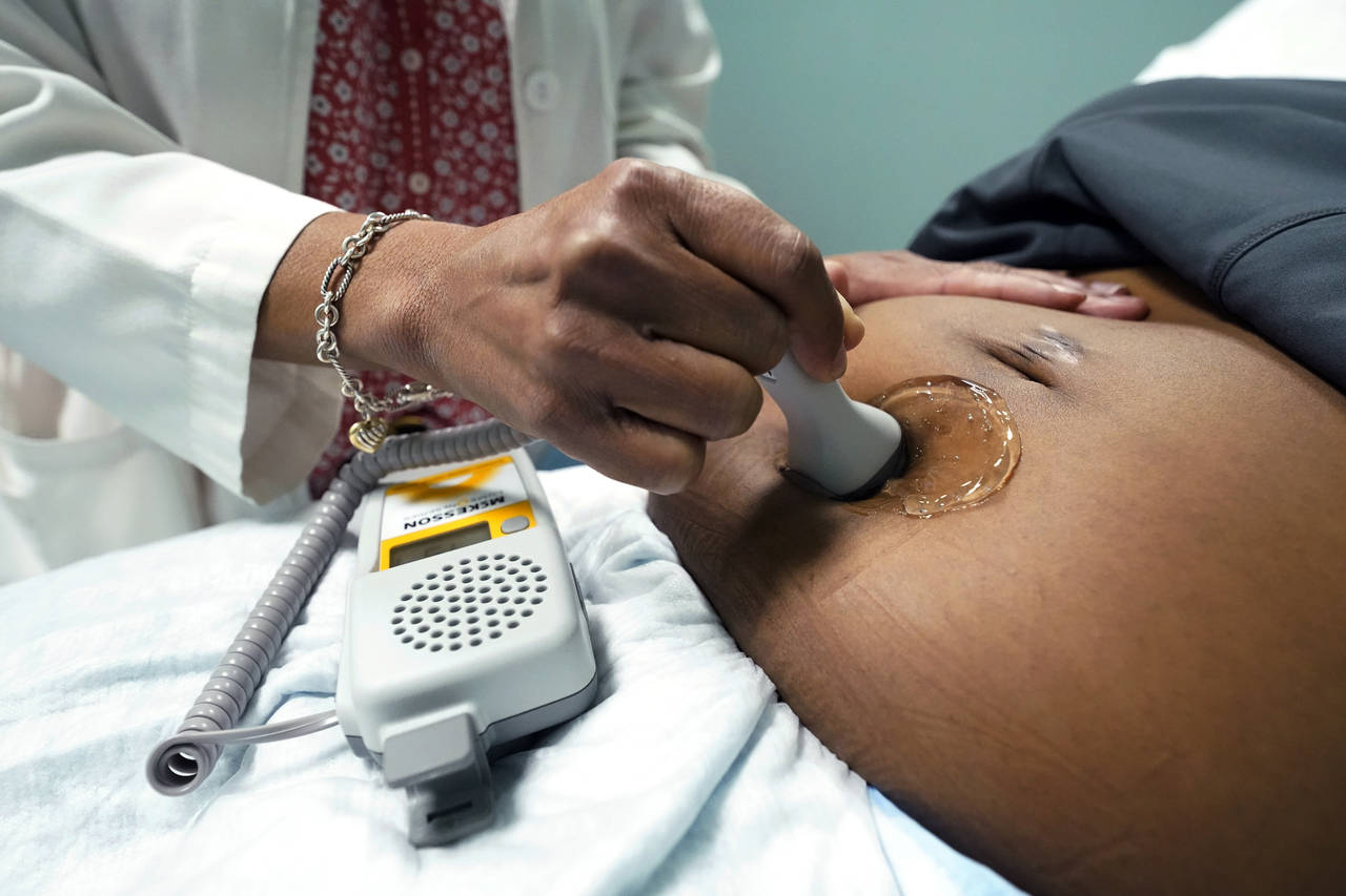 FILE - A doctor uses a hand-held Doppler probe on a pregnant woman to measure the heartbeat of the ...