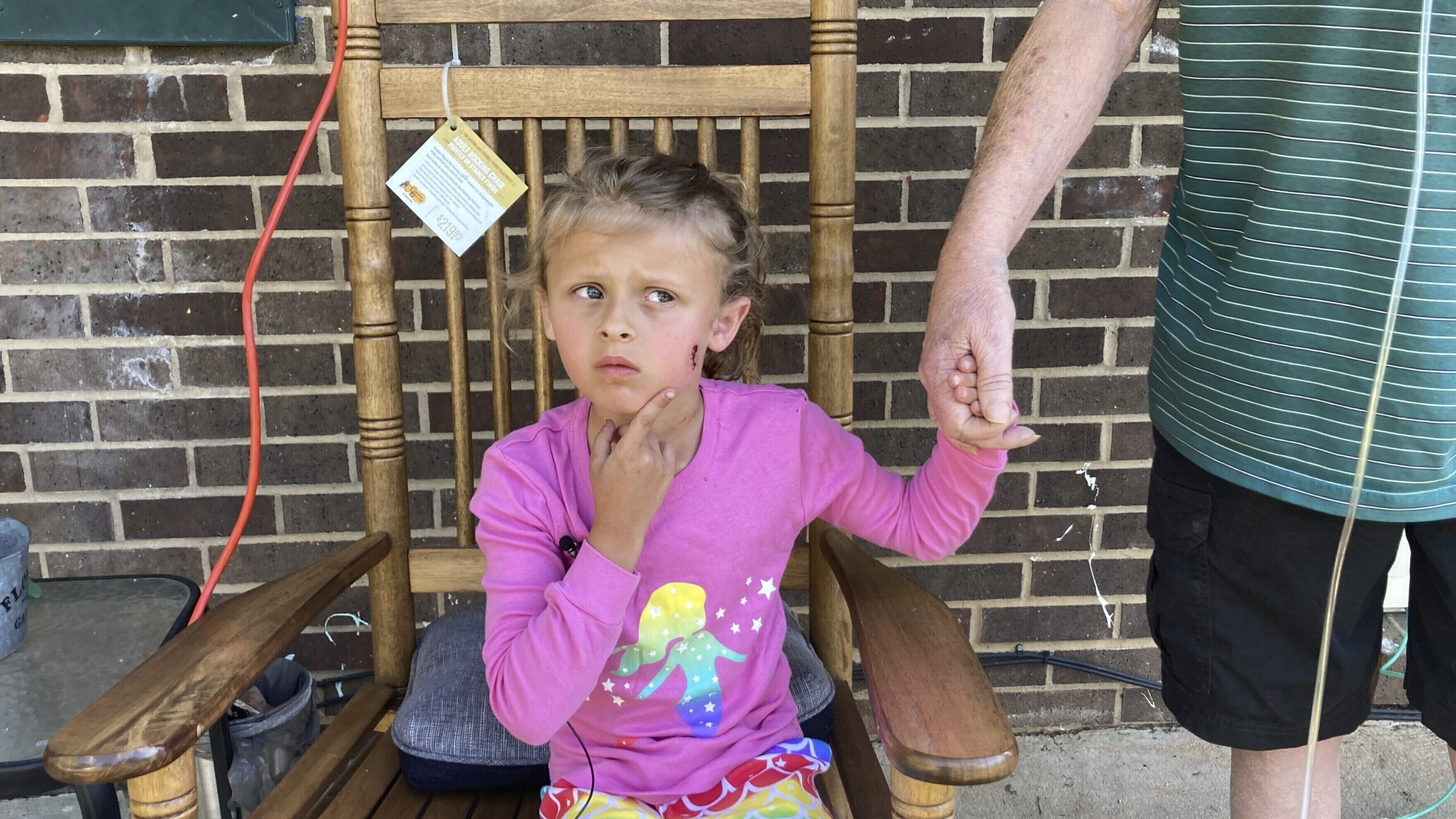 Kinsley White, 6, shows reporters a wound left on her face, Thursday, April 20, 2023 in Gastonia, N...
