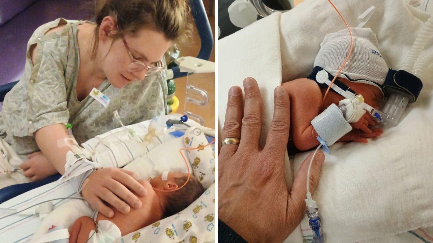 Quadruplets born in Banner hospital in Phoenix January 2025...