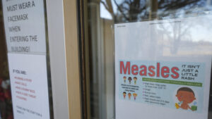Measles exposures reported at downtown Phoenix concert, nearby hotel