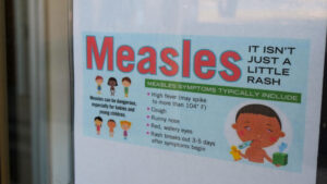 Maricopa County health officials report another measles exposure in East Valley