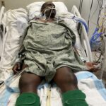 asylum seeker died as toothache progressed into fatal sepsis