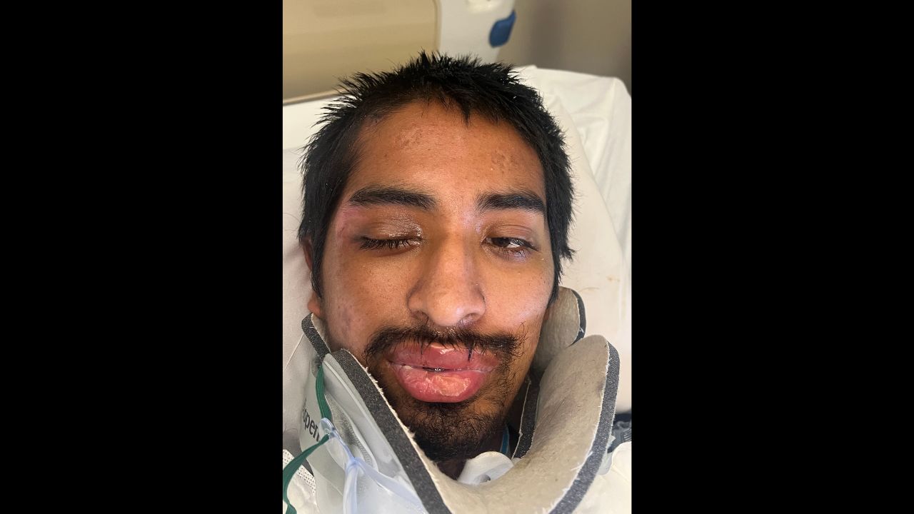Banner Health has determined the identity of a patient who was unable to communicate after he was s...