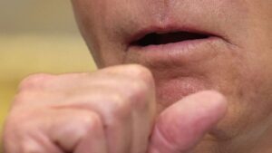 Maricopa County reports 7 new measles cases, bringing total to 21