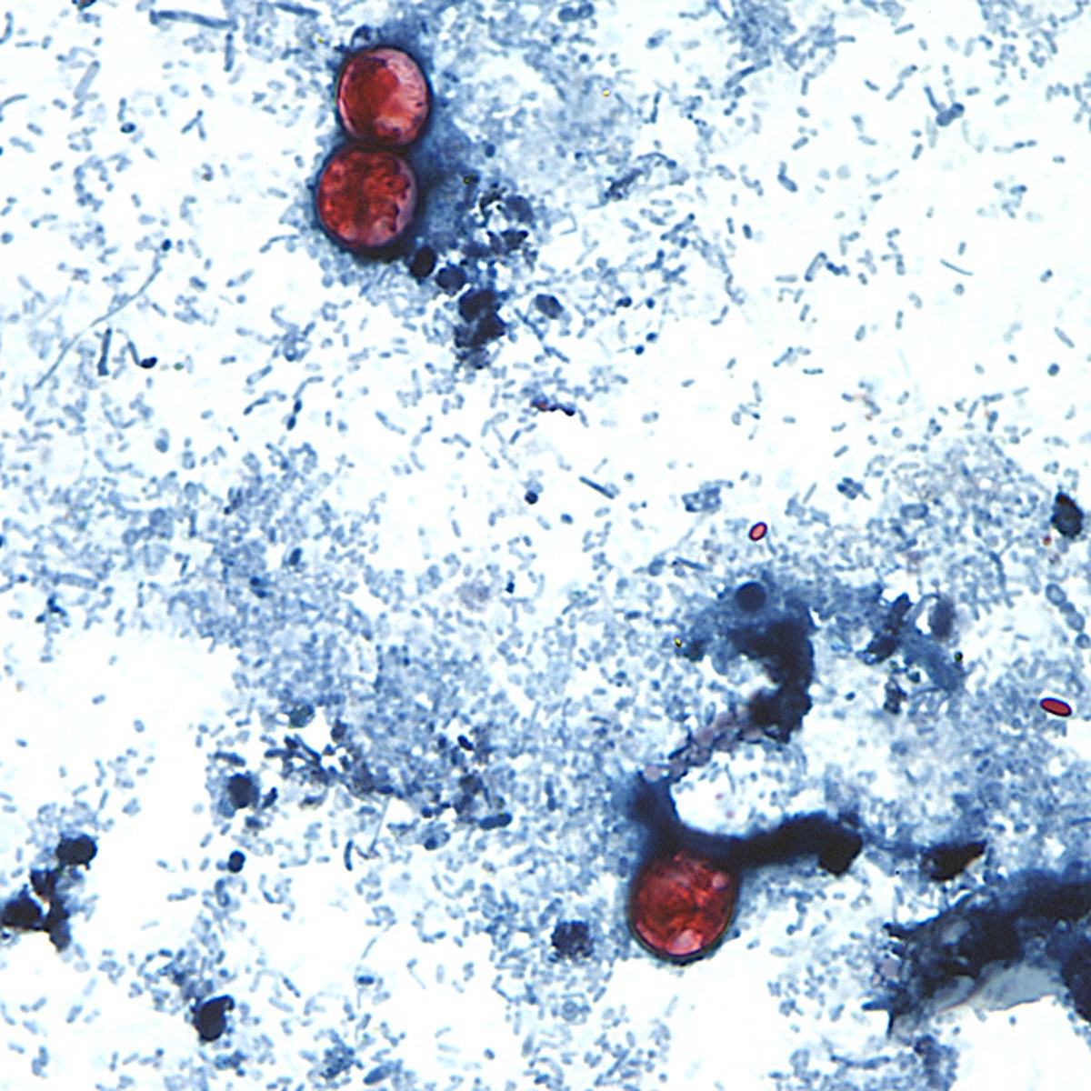 This undated photo taken through a microscope provided by the CDC shows Cyclospora cayetanensis ooc...