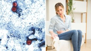 Arizona health officials report 19 cyclosporiasis cases amid national outbreak