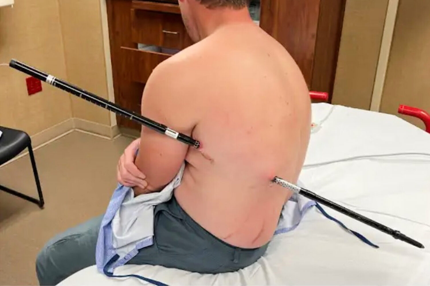 This photo provided by David Cifaldi shows Cifaldi while he was being treated Monday, July 20, 2026...