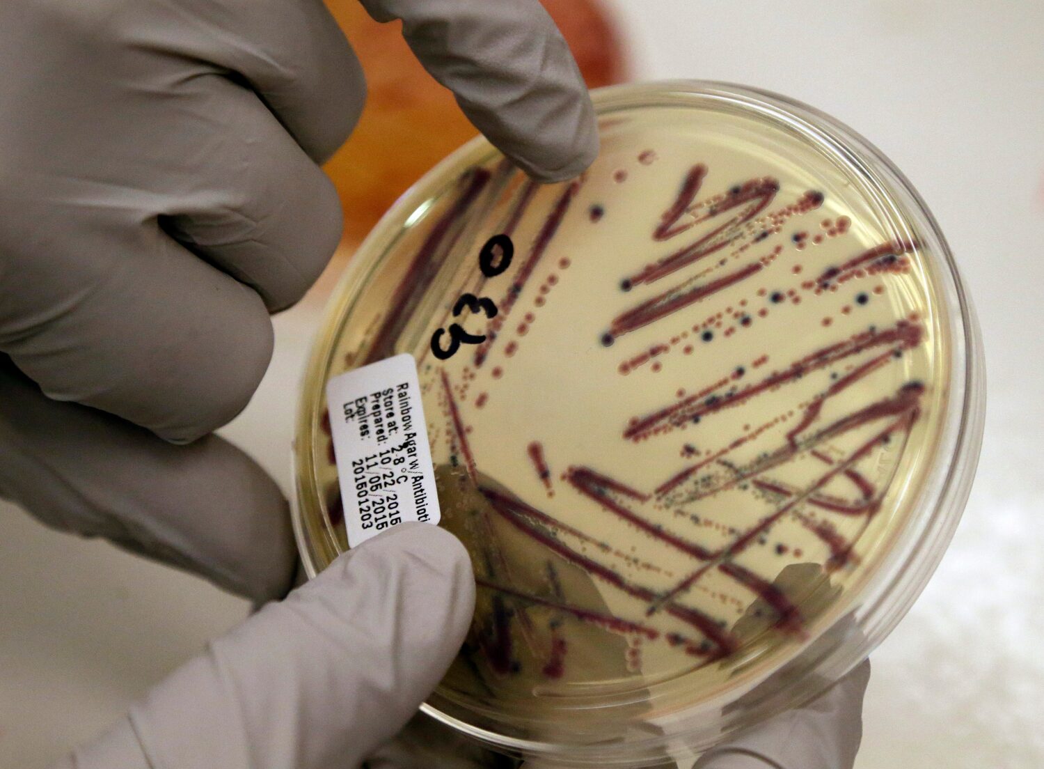 FILE - A microbiologist points out an isolated E. coli growth on an agar plate at the Washington St...