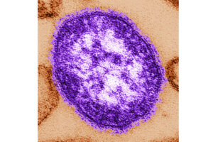 Coroner releases details of infants who died amid growing Pennsylvania measles outbreak